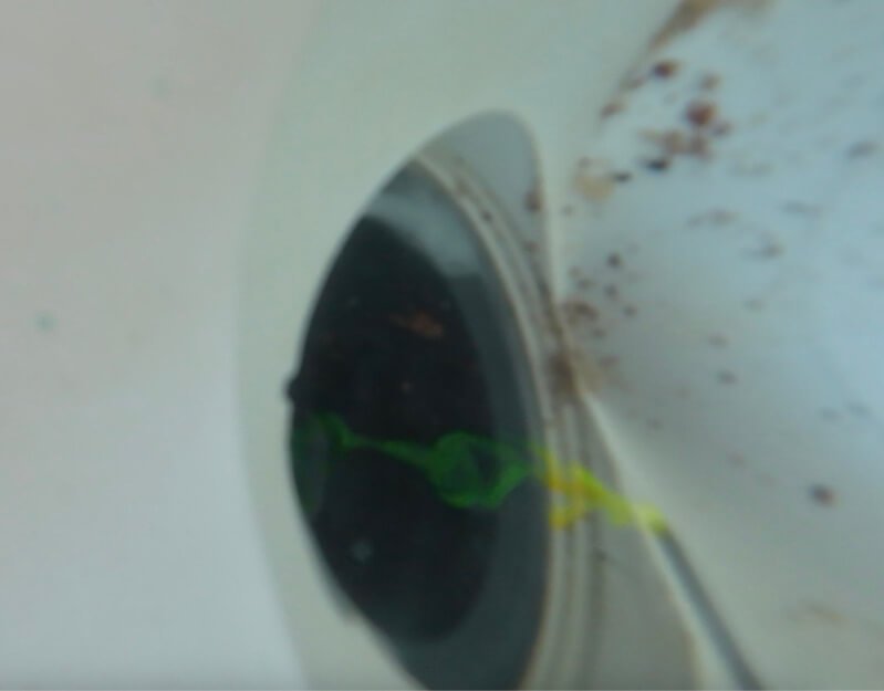Aplicação de líquido traçador no ralo de fundo da piscina durante a inspeção realizada pela TecFuga, evidenciando a passagem do traçador para a tubagem e confirmando a fuga de água no circuito do ralo de fundo.